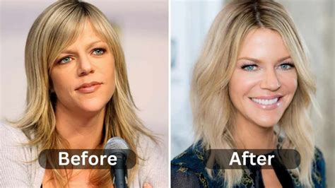 kaitlin olson ass|Kaitlin Olsons Plastic Surgery